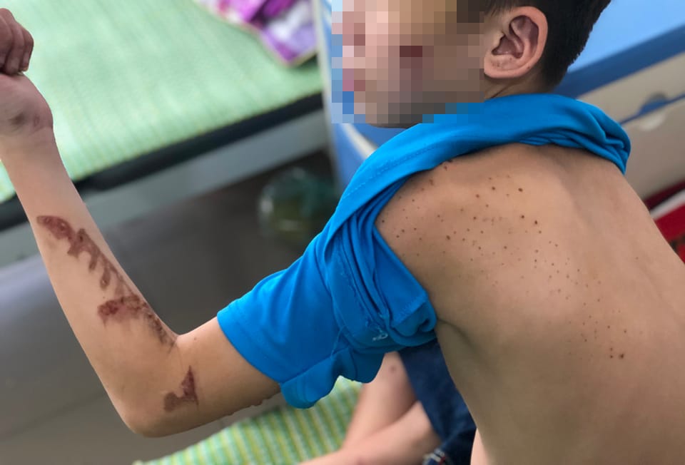 Cậu bé làm thuê bị chủ quán bạo hành